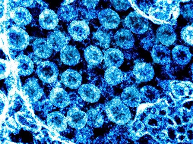 Coronavirus, 6 nuovi casi di positività in Abruzzo su 1189 tamponi analizzati,dati aggiornati 8 maggio 2020