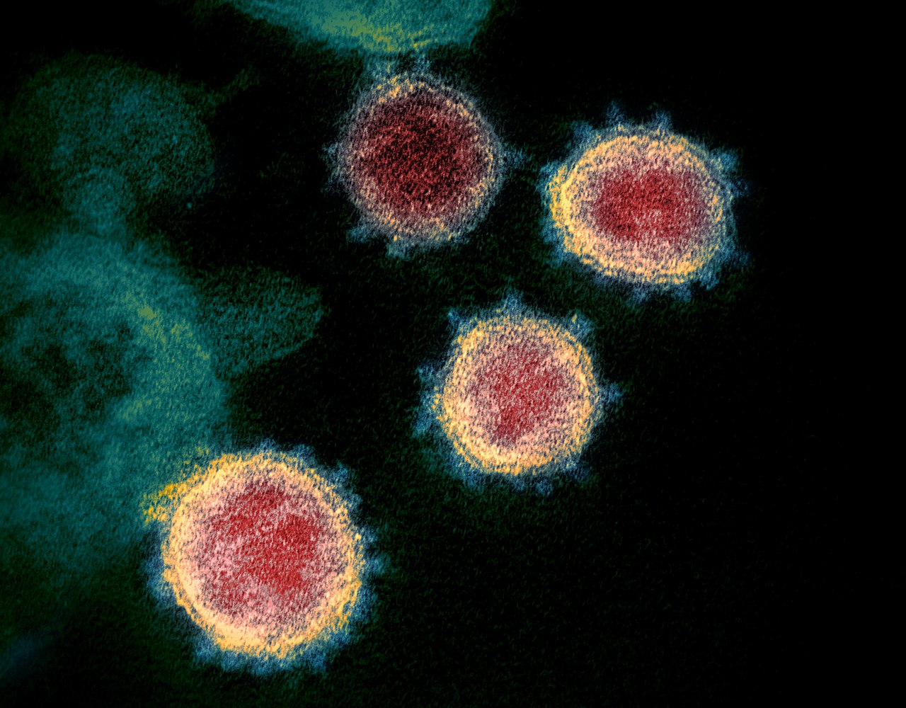 Coronavirus Abruzzo, 26 nuovi casi, positivi salgono a 689. Dati aggiornati al 24 marzo.